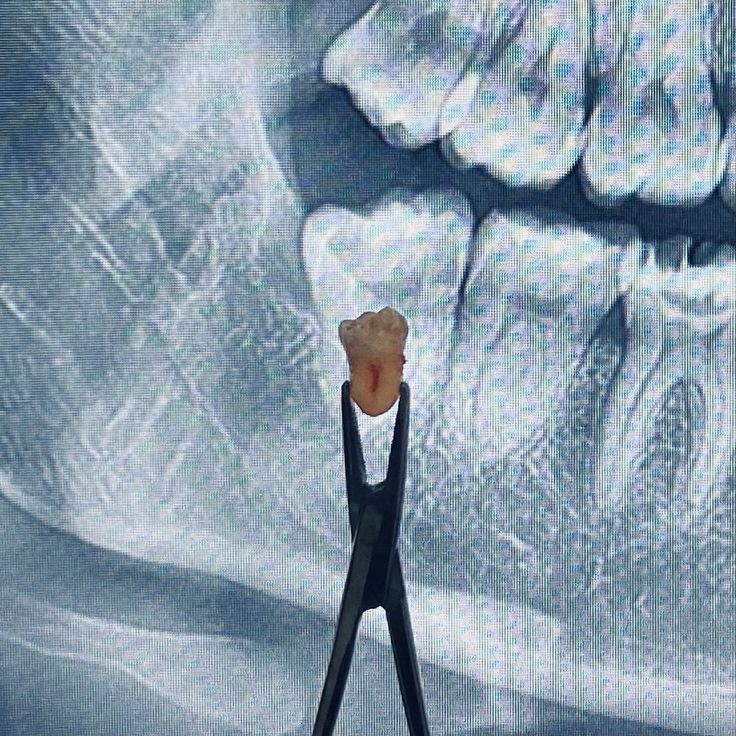 42fd453e-d93d-49f8-b7d3-04a90d25cafe